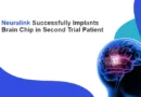 Neuralink-Successfully-Implants-Brain-Chip